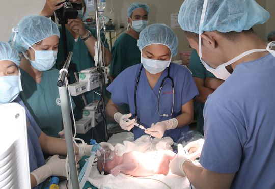 Cháu bé sơ sinh được tiến hành phẫu thuật ngay khi cất tiếng khóc chào đời - ẢNH DO BỆNH VIỆN TỪ DŨ CUNG CẤP